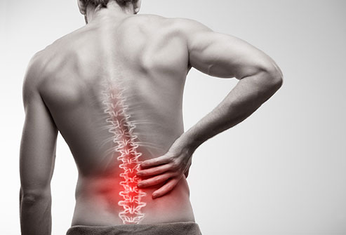 Will strengthening my glutes protect me from lower back pain?